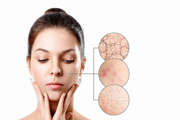 جفاف الجلد – الأسباب والوقاية والعلاج